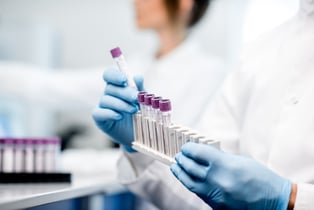 analisis-sangre-alzheimer